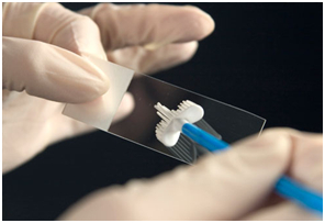 Pap test na infekci lidský papilomavirus